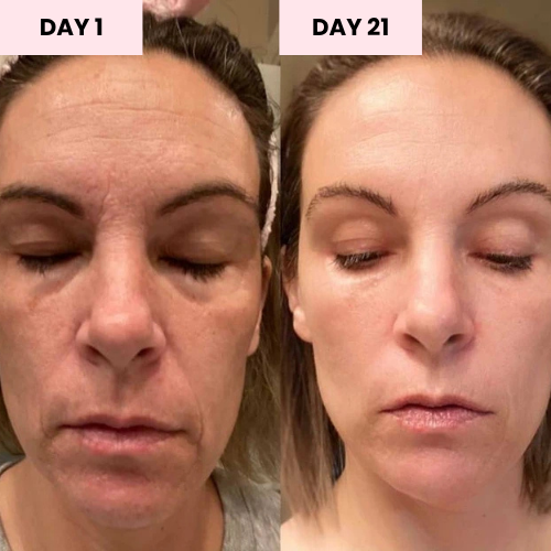 Virelle Red Light Therapy